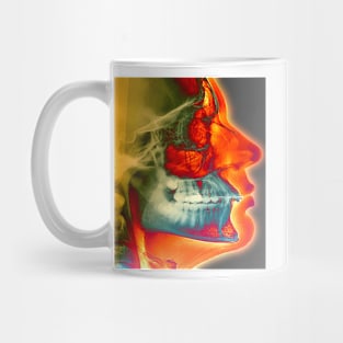 Orthodontic brace X-ray (M780/0342) Mug